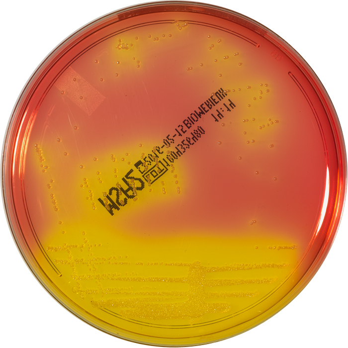 Mannitol salt agar bacillus subtilis