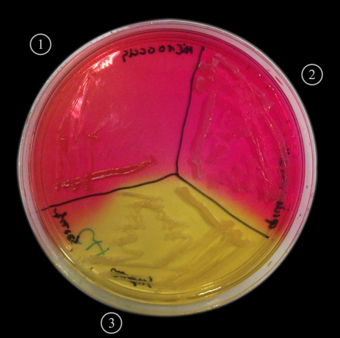 Agar salt mannitol test microbiology results catalase differential samantha lab sarah journal before