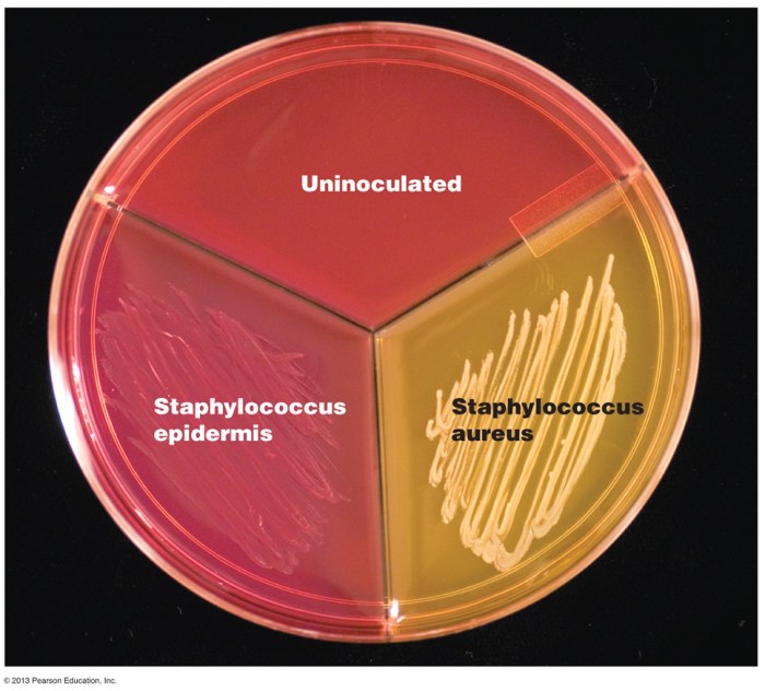 Mannitol salt agar bacillus subtilis